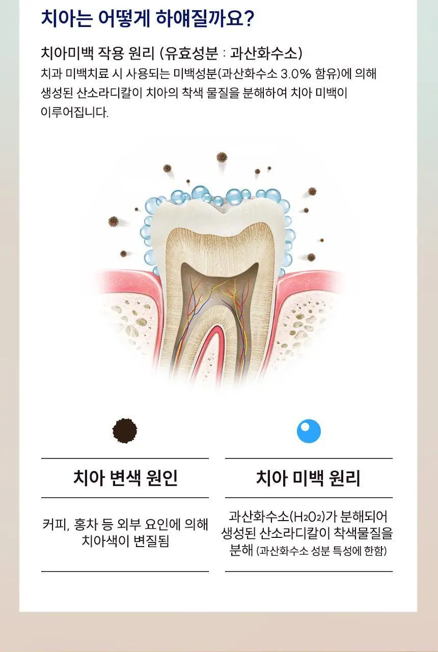 [강력 미백케어] 뷰센30 치아미백제 80g 상세페이지 9